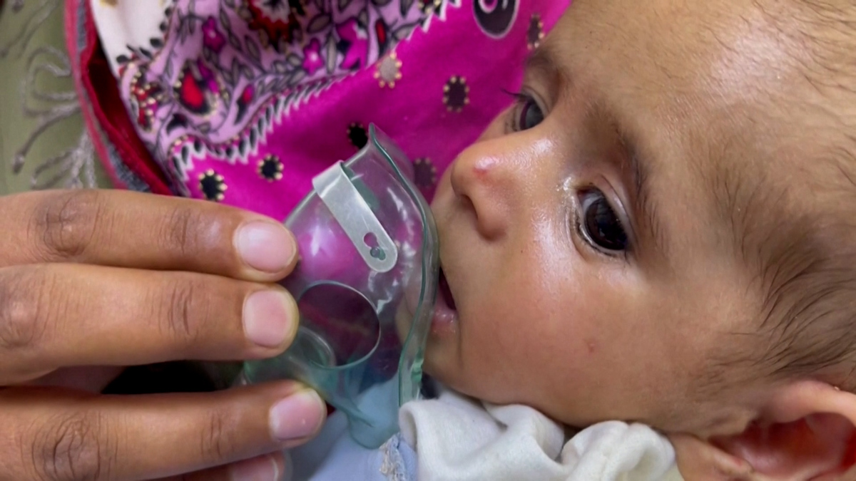 AFGHANISTAN CHILD MALNUTRITION