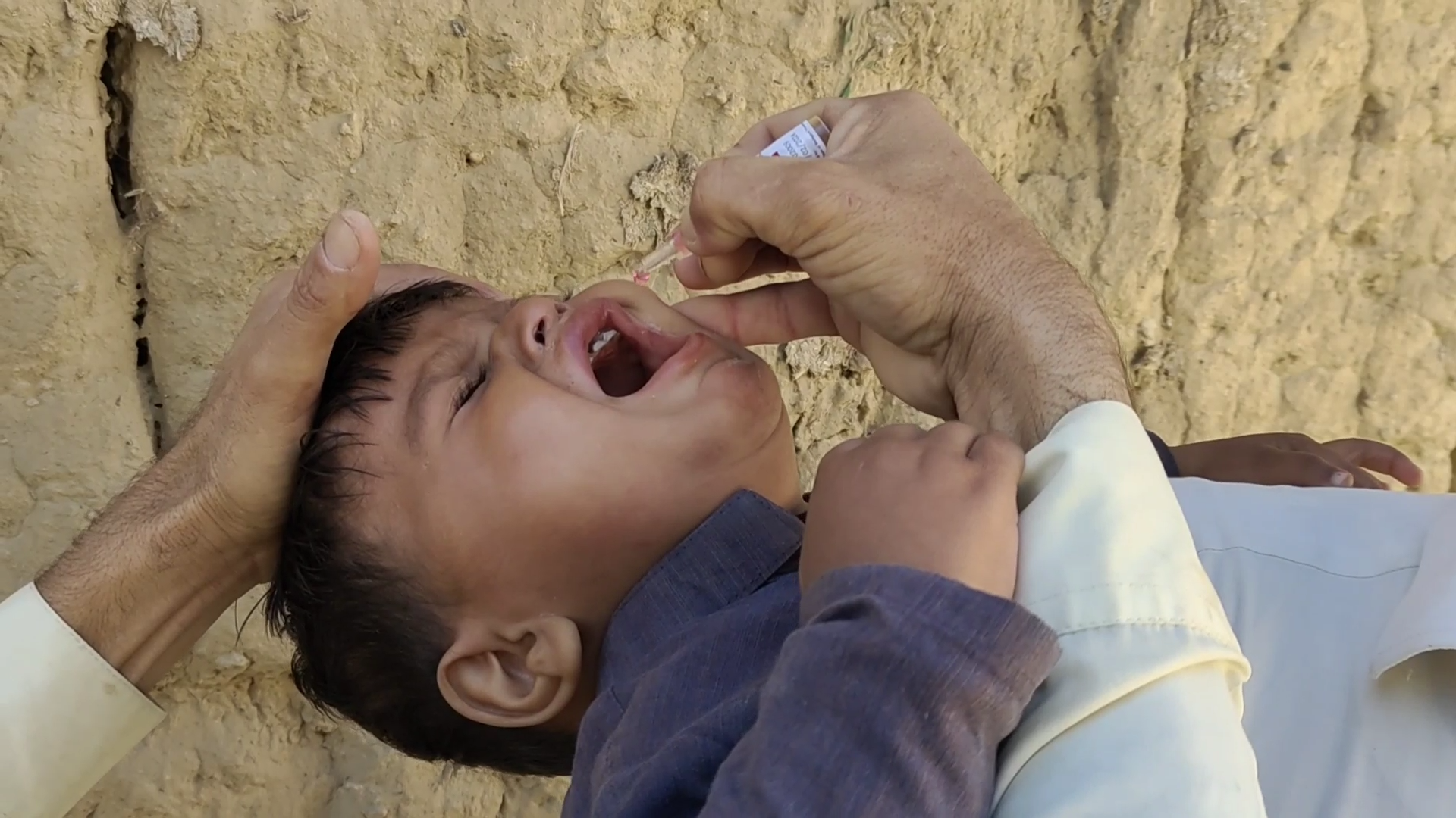 Polio Bajur