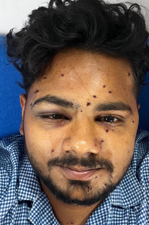 Indy Pellet gun victims .jpg